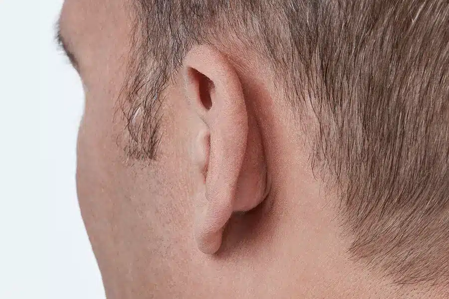 Oticon Own™ - Image 2