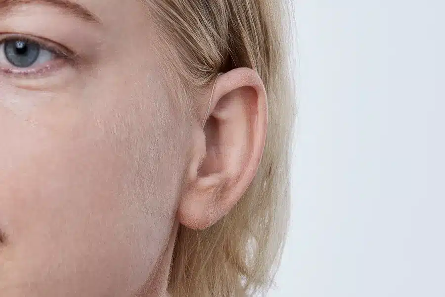 Real™ miniRITE T - Image 3