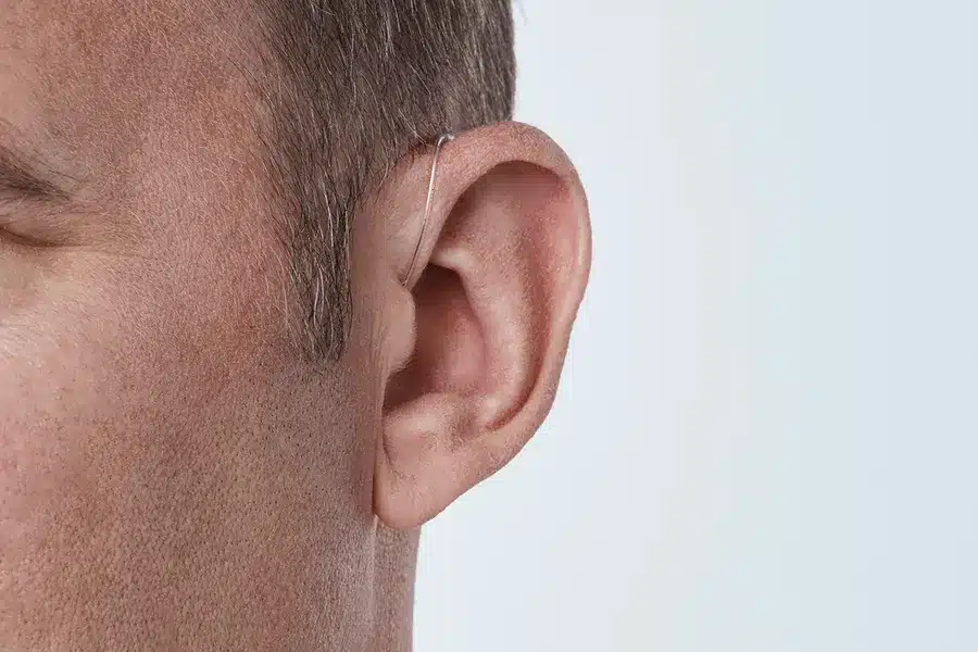 Real™ miniRITE T - Image 6